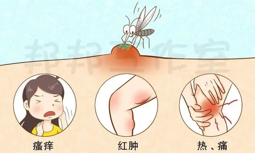 蕁麻疹2.jpg