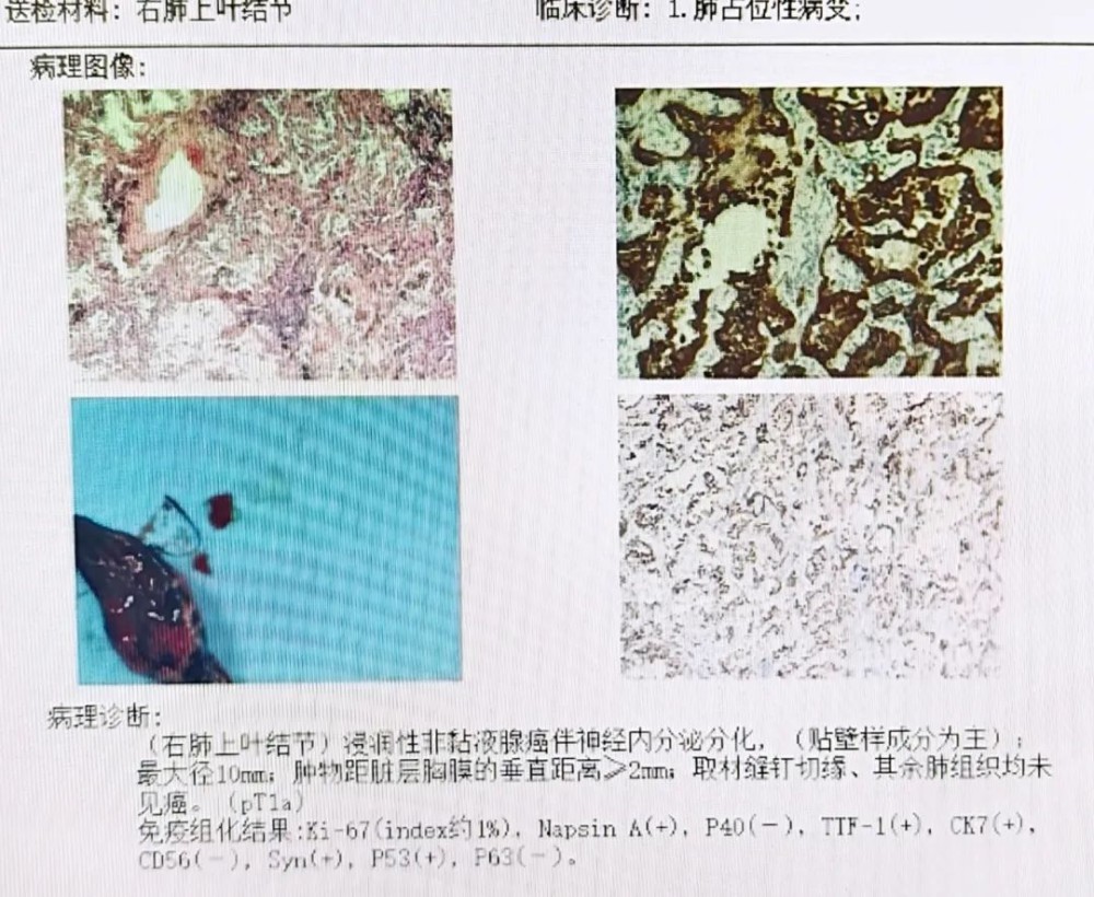 圖片30.png
