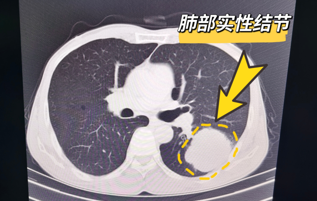 圖片1.png